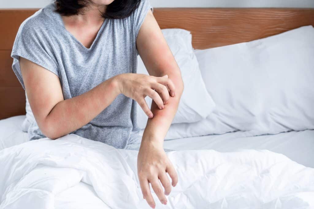 ¿Puedo tener alergia a las sábanas de bambú?
