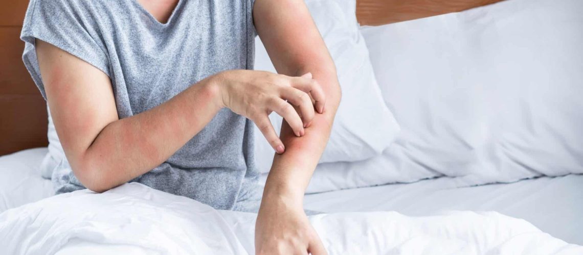 ¿Puedo tener alergia a las sábanas de bambú?